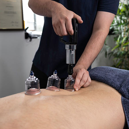 chiropractic treatment cupping Gregory Hills