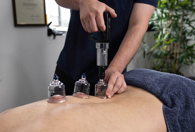 chiropractic cost, cupping, oran park